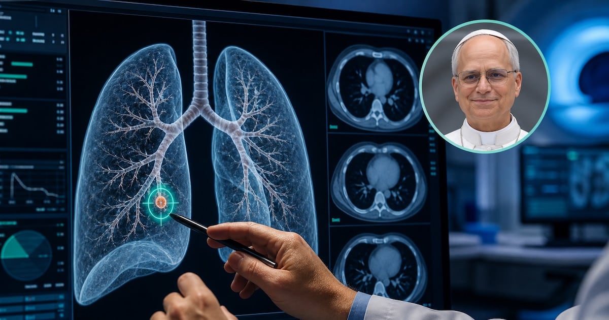 Nódulo pulmonar: por qué a veces se opera aunque mida apenas tres milímetros