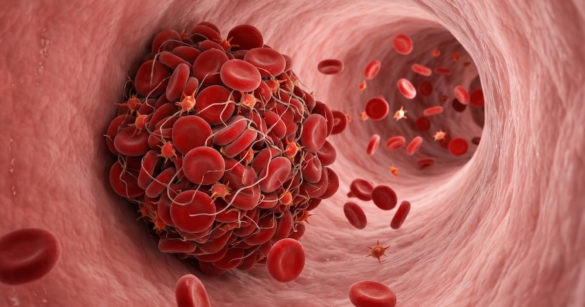 Cuando el cuerpo avisa: las cuatro señales que encienden la alerta por un coágulo